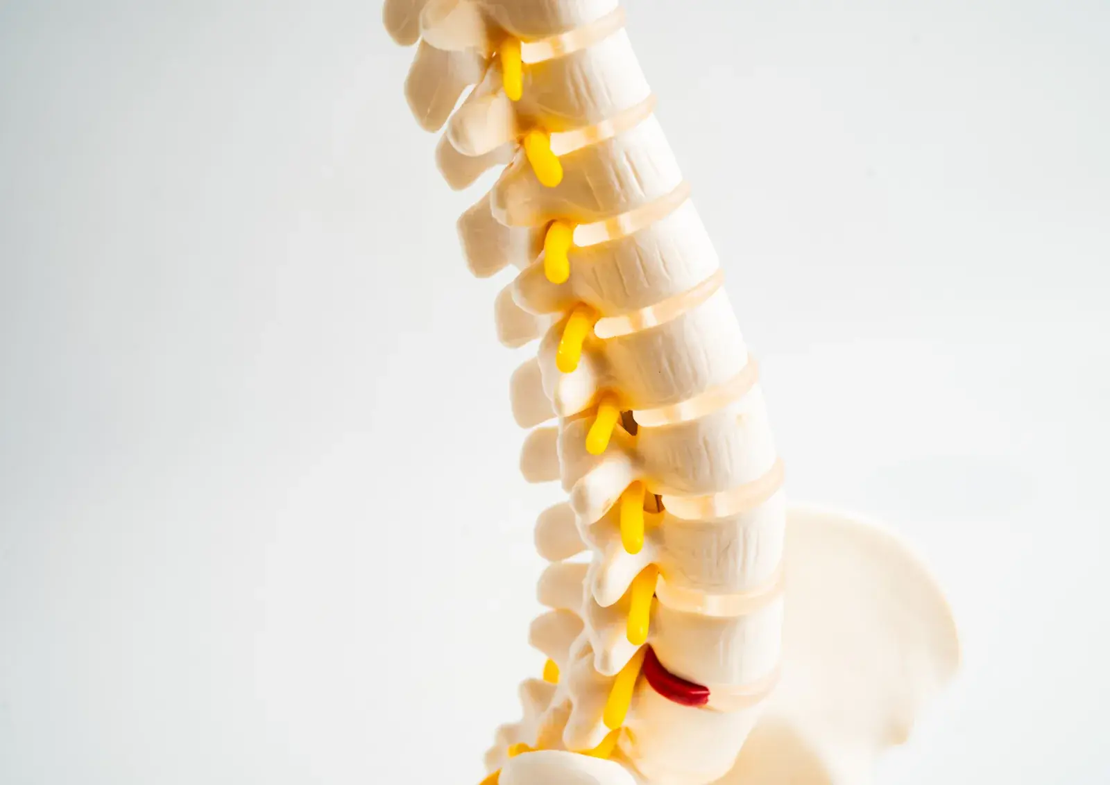 Modello anatomico della colonna con i dischi intervertebrali