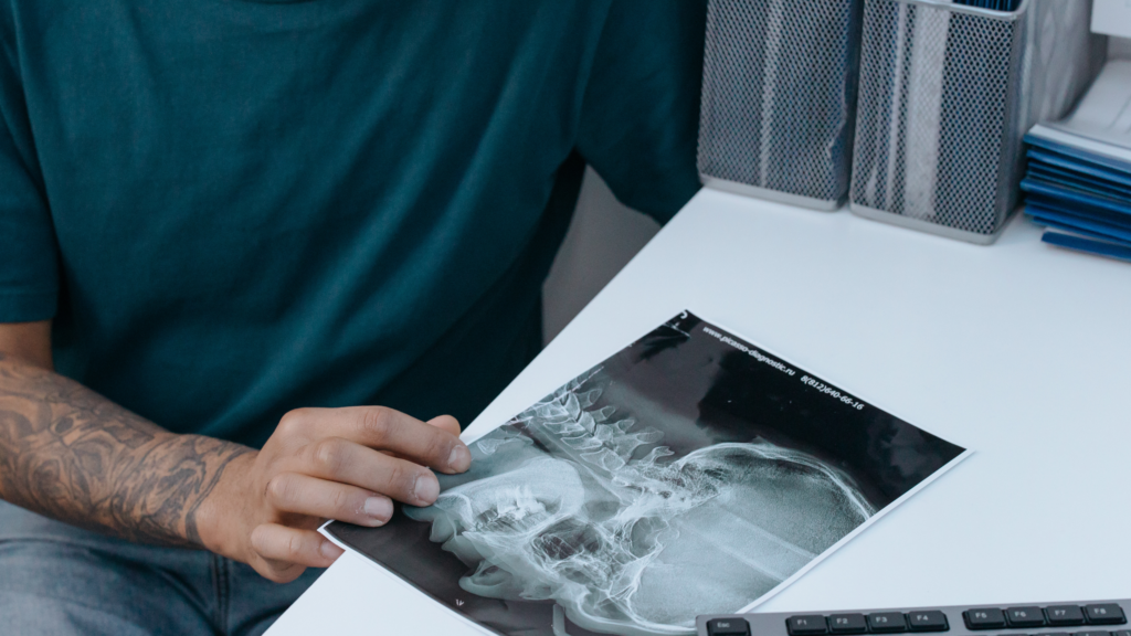 Radiografia cervicale